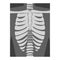 Roentgenograph of Spine and Back Bone Vector Image