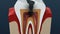 Root canal infection process