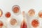 Rose wine assortment in crystal glasses, bottle of rose champagne sparkling wine. Summer alcoholic drink