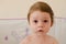 Roseola infantum