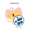 Rotavirus infection or stomach flu. Small intestine and colon