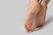 Rough skin on female feet on grey background. Dry and cracked soles of feet on white background, womans feet with dry heels,