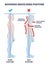 Rounded shoulders posture with body alignment forward outline diagram
