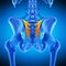 The sacroiliac ligament