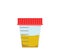 Sample of urine test vector illustration. Containers for analysis