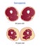 Sarcopenia, loss muscle mass and strength vector illustration.