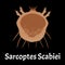 Sarcoptes scabiei. scabies. Sexually transmitted disease. Infographics. illustration on isolated background.