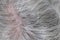 Scalp of Aging Person with Grey Hair