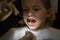 Scared little girl at the dentists office, in pain during a treatment