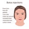 Scheme for beauty injections. Wrincles, woman face.
