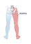 Sciatica pain or nerve weakness as leg lumbar radiculopathy outline diagram