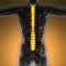 Science anatomy of human body in x-ray with glow back bones