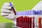 Scientist hand holds coronavirus blood sample tube