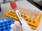 Scientist hold blood samples for Phenytoin test,