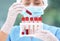 Scientist holding test tubes with blood samples