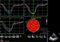 Screen of echocardiography ultrasound machine