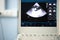 A screen of an ultrasound device with a heart scan and tricuspid regurgitation shown.