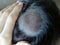 Seborrhea of â€‹â€‹the scalp, treatment of skin diseases