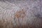 Seborrheic keratosis on hairy skin