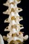 A section of a human spine showing the vertibrae and spinal cord.