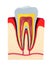 Section of the tooth. pulp with nerves