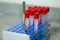 Selective focus on blood test tubes in a lab put to analysis