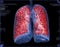 Selective focus of CT Chest or Lung 3D rendering image on the monitor  for diagnosis TB,tuberculosis and covid-19