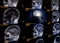 Selective focus of MRI brain sagittal plane