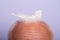 Senior man haircare. Closeup old bald male. Hair loss, baldness, health problems, aging.