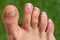 set of the 5 toes of the right foot of a human being on a green background