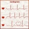 Set of cardiograms