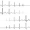 Set icons symbol death resurrection, vector, symbol heartbeat attenuation and resuming of the heart beats