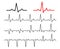 Set Lines heartbeat normal. Line cardiogram heart on white background.