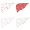 Set of liver health low poly wireframe. Polygonal anatomic model of human liver made of stars, lines, dots, triangles. Medical and