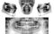 Set of Panoramic dental X-Ray