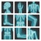 Set of x-ray shots pictures of human body parts, head, wrist, rib cage, foot, spine, knee, cubit, shoulder, vector