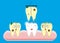 Set of teeth cleaning and whitening concepts. Scaler, laser, mechanical, paint. Cartoon vector dental