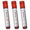 SFTS virus and test tubes with patient analyzes. Vector set of illustrations. Isolated white background. Three results. Collection