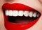 Shiny smile with whitening teeth and bright red lips. Dental photo. Macro of fashion makeup