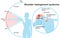 Shoulder impingement sydrome. Painful arc. Labeled Illustration