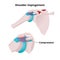 Shoulder impingement vector illustration. Illustration of the muscle tendon and bursa compression