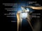 Shoulder joint, glenohumeral joint, medical 3D illustration
