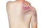 Shoulder muscle pain