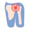 Shoulder pain icon cartoon vector. Arthritis joint