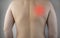 Shoulder pain. A man at a doctorâ€™s appointment with a vertebrologist complaining of pain in the interscapular region and back