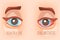 Sick eyes, eye conjunctivitis. Eyecare illustration