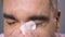 Sick male sneezing and wiping nose with paper napkin, close-up view of face