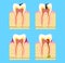 Sick Teeth - caries, periodontal disease, pulpitis. branch of medicine stomatology. pathology of teeth