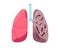 Sick unhealthy lungs tuberculosis infection disease. Human respiratory system internal organ tubercle bacillus infected
