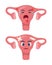 Sick uterus with pain ache or disease. Sad cartoon character uterus, body organ injured or unhealthy. Human cartoon anatomy, kids